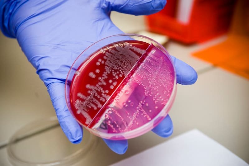 Mão enluvada segurando placa de Petri com cultura microbiológica.